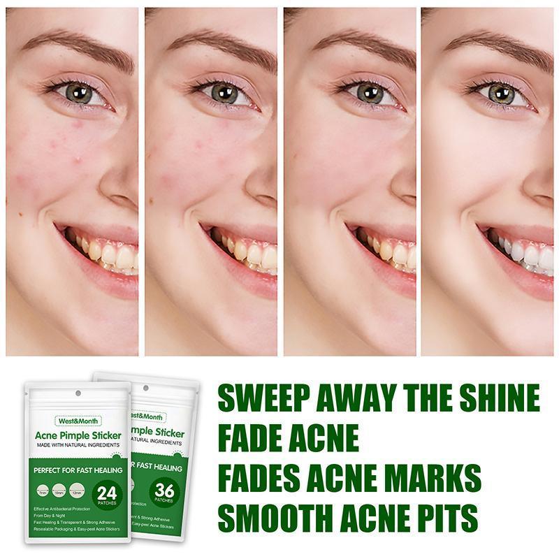 Skin Tag Remover Acne Pimple Patch Removal Facial Care Spot Plaster - 24 PCS
