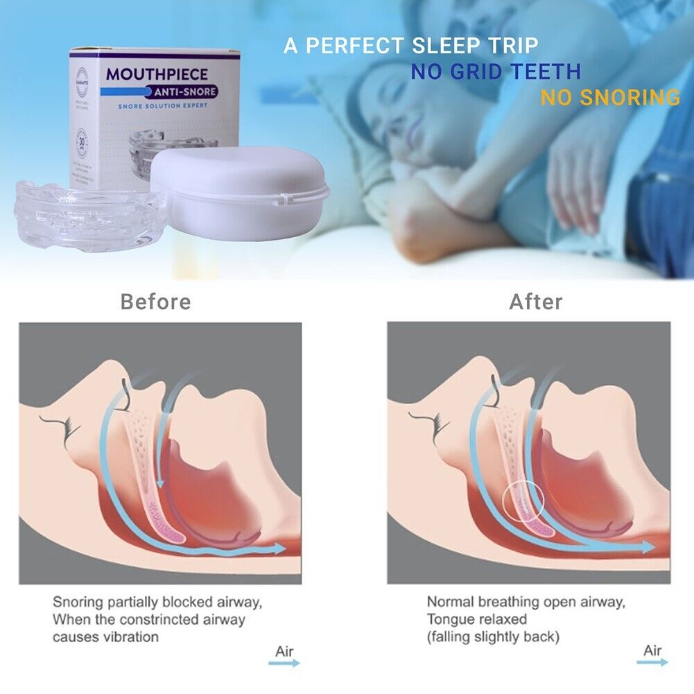 Anti Snore Mouthpiece Mouth Guard Stop Snoring Grinding Sleep Aid Mouthguard