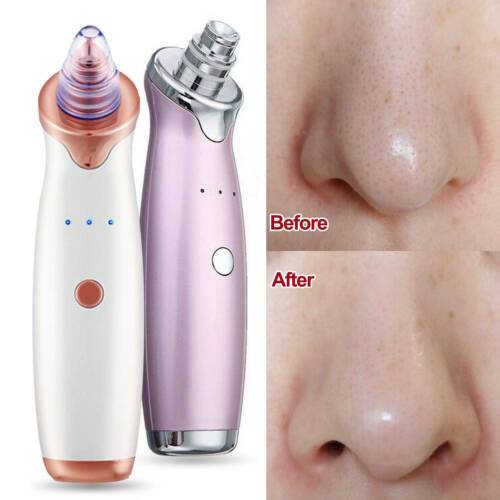 Blackhead & Pores Vacuum Cleaner Remover Electric Vacuum Pore Cleaner Blackhead Remover Acne Facial Suction Machine