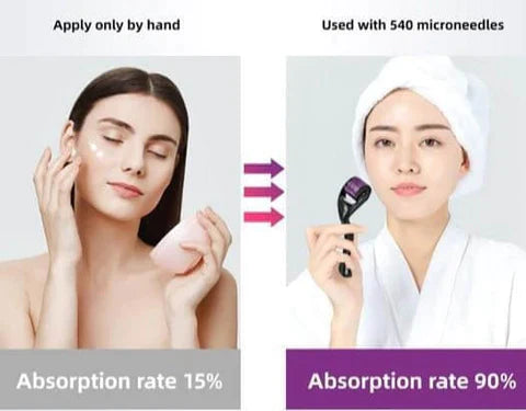 Derma Roller For Hyperpigmentation