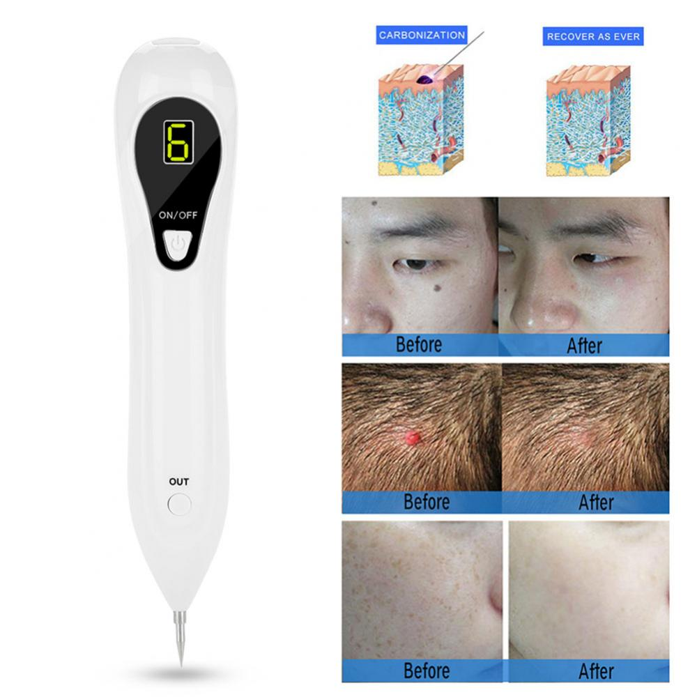 Skin Care Laser Pen Freckle Tattoo Skin Spots Mole Wart Pimple Verrugas Removal Pen