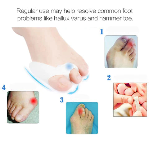 Gel Bunion Toe Corrector