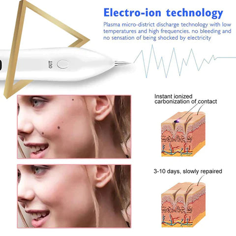 Skin Care Laser Pen Freckle Tattoo Skin Spots Mole Wart Pimple Verrugas Removal Pen