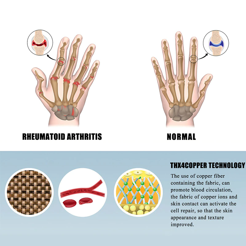 Arthritis Therapeutic Compression Gloves Wrist Support Cotton Joint Pain Relief Hand Brace Women Men Therapy Wristband
