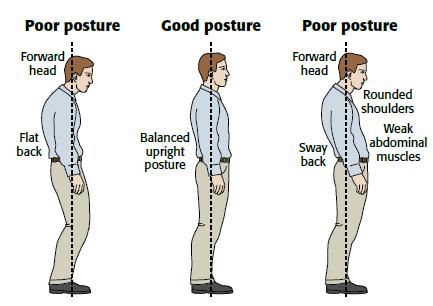 Body Solution™ Posture Corrector (Adjustable to Multiple Body Sizes)